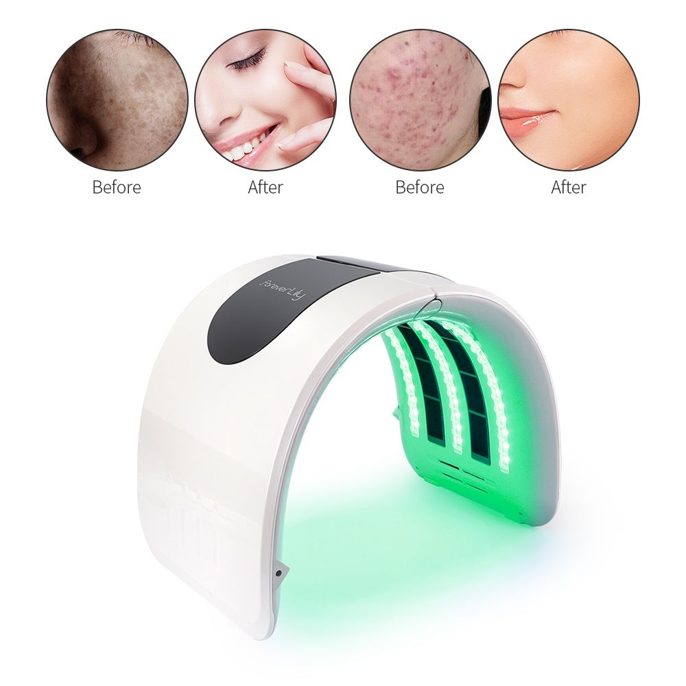 Alternate view: Photon skin rejuvenation device